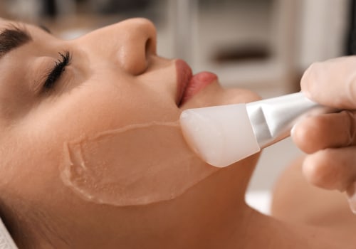 Exploring the Benefits of Chemical Peels in Medical Aesthetics