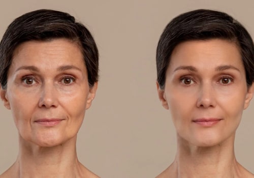 Exploring Alternatives to Medical Aesthetics for Enhancing Your Appearance